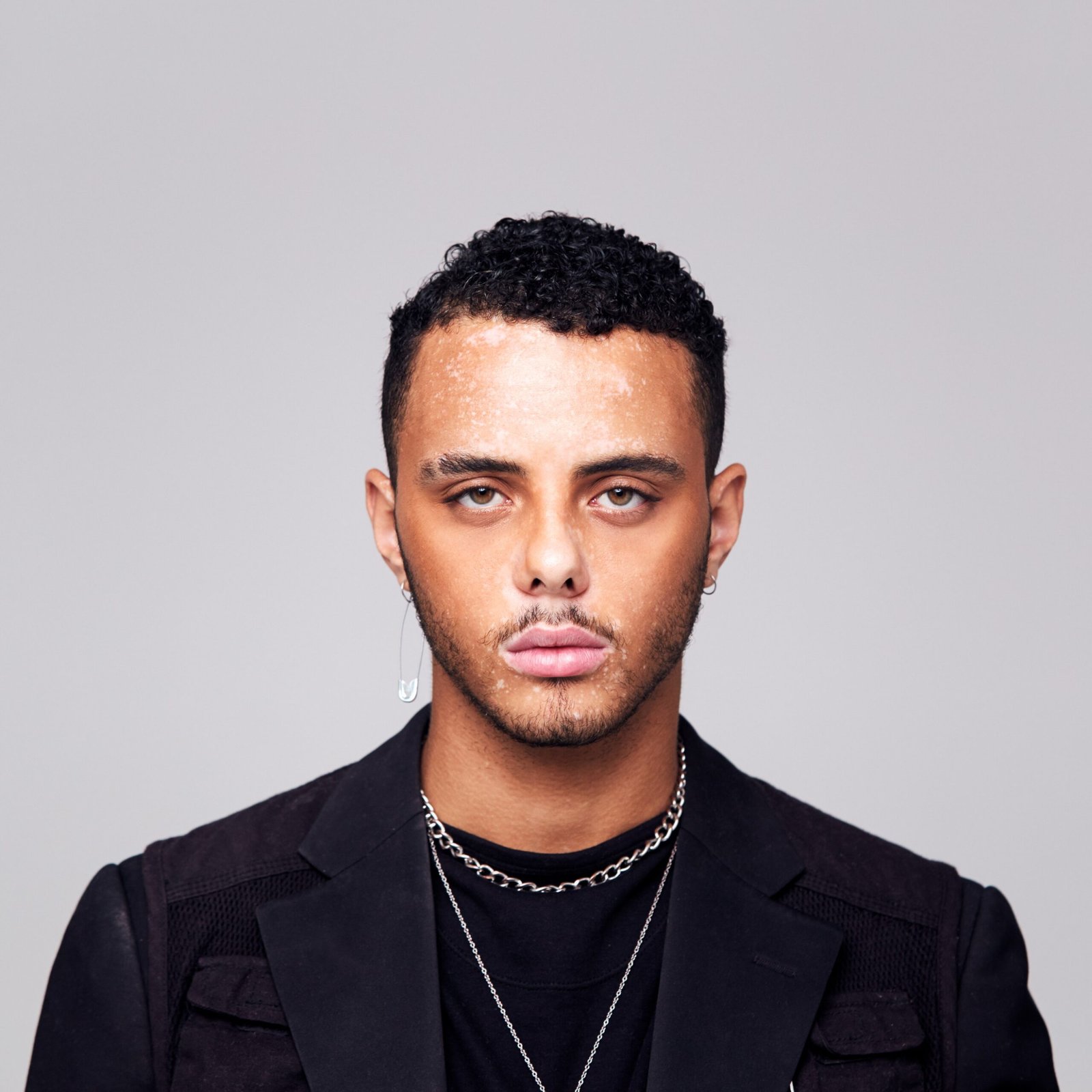 studio portrait of young man with skin pigmentatio rf79l22 scaled.jpg